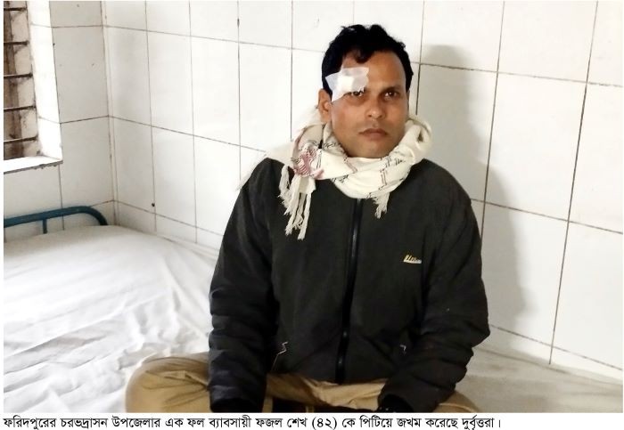 চরভদ্রাসনে ব্যাবসায়ীকে পিটিয়ে জখম করেছে দুর্বৃত্তরা