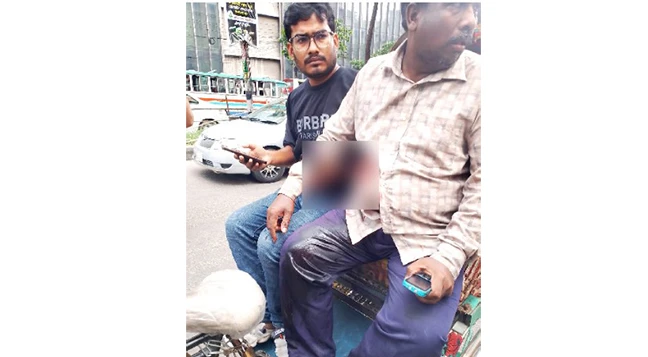 মতিঝিলে গুলি করে টাকার ব্যাগ ছিনতাই, টাকার পরিমাণ নিয়ে ধোঁয়াশা